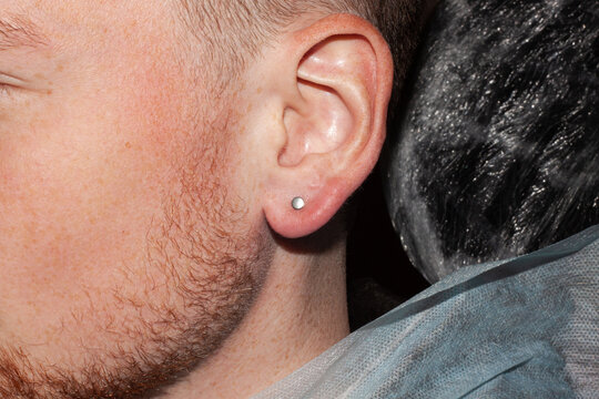 Male earlobe piercing. Just made piercing. Titanium labret, top flat plate.