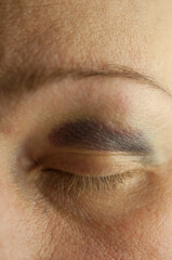 Sad beaten up girl with wounds on the face looking at the camera with deep look