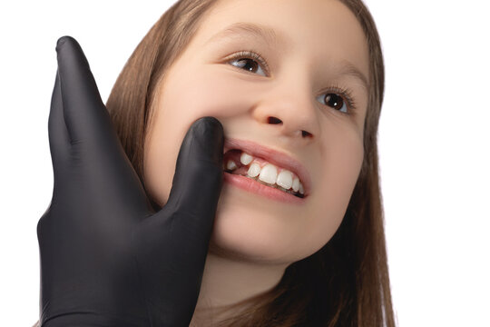 A doctor in black gloves examines the place of the child's oral cavity in which a molar tooth was recently removed. Studio photo on a white background.