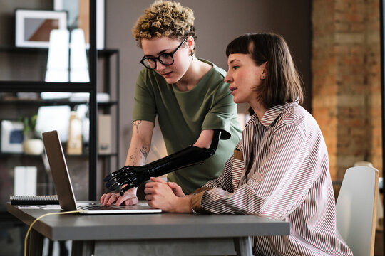 Young woman with prosthetic arm pointing at laptop and talking to her colleague during work at office