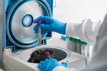 Centrifuging sample in a laboratory