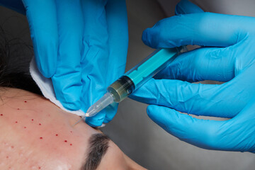 Injection at spa salon. Doctor hands in gloves. Closeup. Pretty male patient. Beauty treatment....