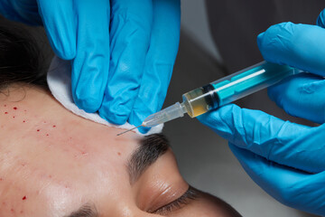 Injection at spa salon. Doctor hands in gloves. Closeup. Pretty male patient. Beauty treatment....
