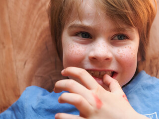 red-haired freckled boy portrait. child biting nails with teeth