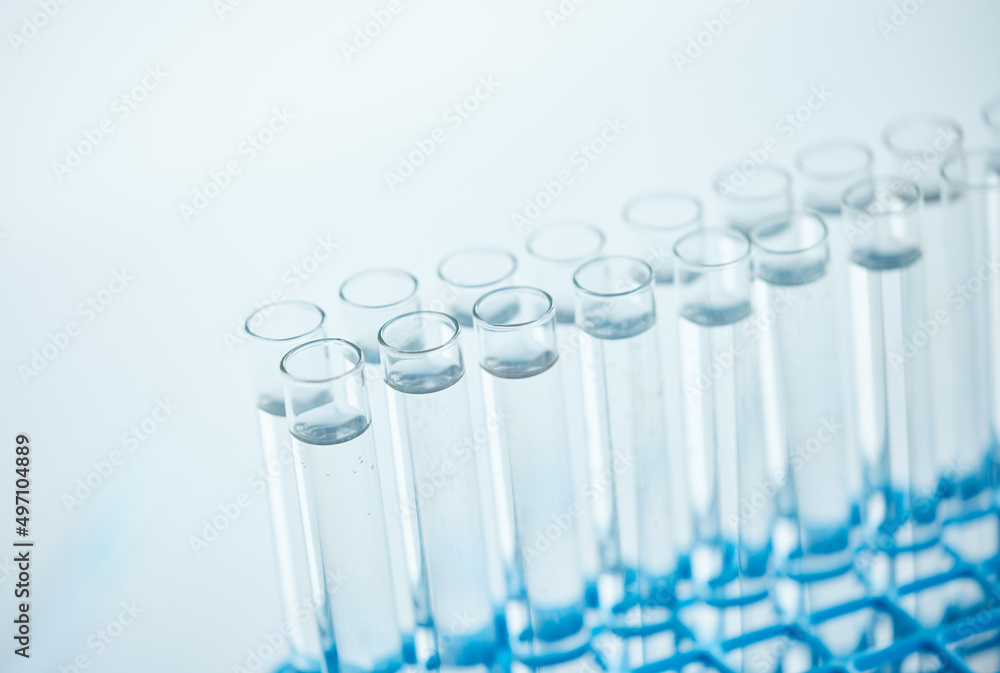 Poster a small sample can tell a big story. closeup shot of test tubes filled with liquid in a lab.
