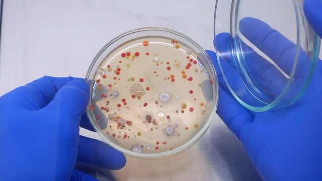 Close-up, a scientist opens a petri dish with colonies of bacteria, examines the red colonies of microorganisms.