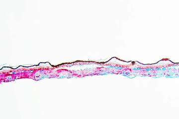 Rhytisma acerinum black spot disease on a maple leaf under the microscope