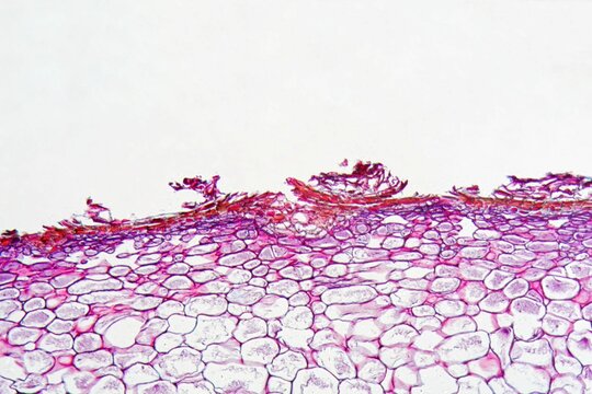 Venturia pyrina under the microscope