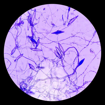 Microscopic finding shows macroconidia of Microsporum canis in dog with skin disease. a ringworm infection in pets.