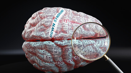 Down syndrome in human brain, a concept showing hundreds of crucial words related to Down syndrome projected onto a cortex to fully demonstrate broad extent of this condition, 3d illustration