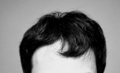 薄毛の日本人男性