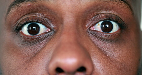 African man SHOCK reaction. Macro close-up person face expression with surprise