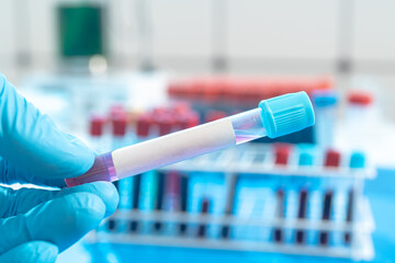 Test tube with empty label  to laboratory research