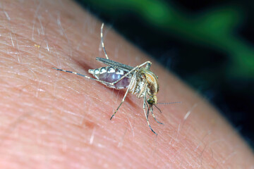 Dangerous Malaria Infected Mosquito Skin Bite. Leishmaniasis, Encephalitis, Yellow Fever, Dengue,...