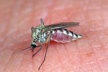 Dangerous Malaria Infected Mosquito Skin Bite. Leishmaniasis, Encephalitis, Yellow Fever, Dengue, Malaria Disease, Mayaro or Zika Virus Infectious. Culex - Blood-sucking mosquito on human skin. 