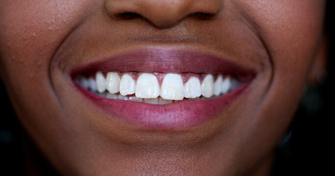 Black girl mouth smiling macro close-up white teeth, african ethnicity
