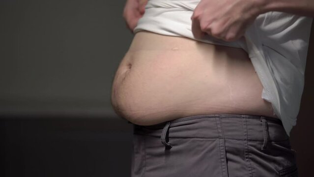 Fat man. Man touches his stomach. Belly, overweight. Oversize person holds skin.