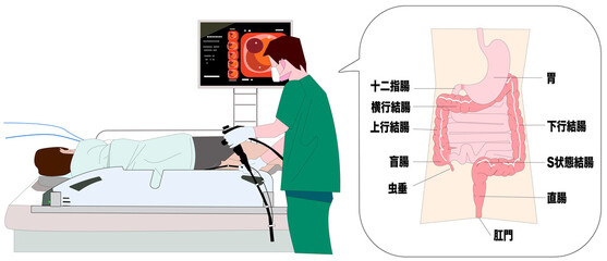 大腸内視鏡検査と内臓と大腸