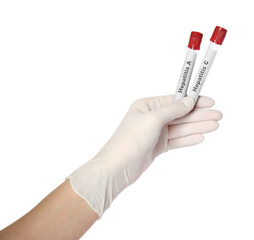 Scientist holding tubes with blood samples for hepatitis virus test on white background, closeup
