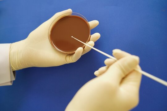 Scientist streak selective blood agar culture medium plate for antibiotic resistance test Drug resistant gonorrhea.