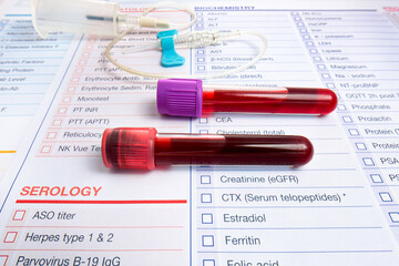 requisition form with Blood tubes samples and butterfly needle and adapter for analysis in the...