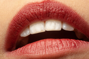 geöffneter Mund mit roten Lippen und Schneidezähnen