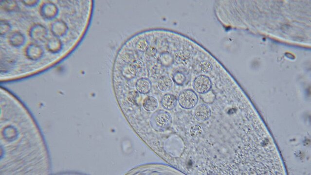 High density of unicellular paramecium  protozoa under microscope