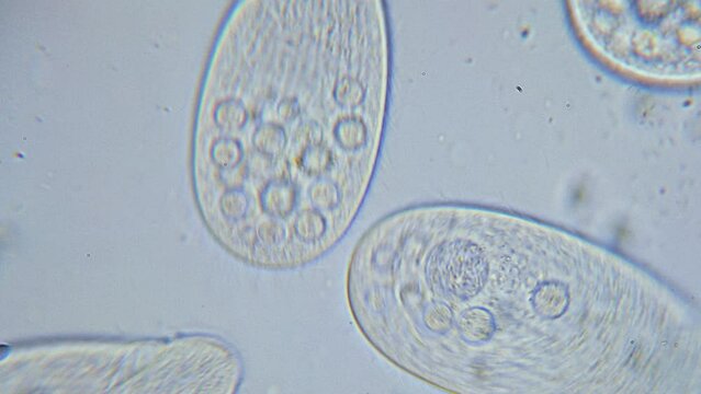 High density of unicellular paramecium  protozoa under microscope