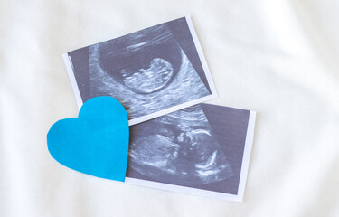 ultrasound picture with fetus on rope or little white easel. white bib and toy teething. baby...