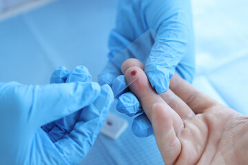 Doctor with blood sample on glass in laboratory closeup