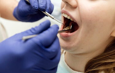 dental treatment process. the dentist holds the tools in his hands and examines the teeth. patient at the dentist. dental office.