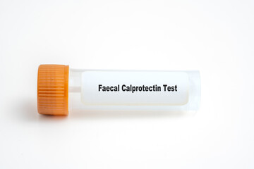 Faecal Calprotectin Test.
