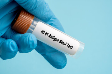 40 41 Antigen Stool Test