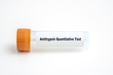 Antitrypsin Quantitative Test