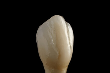 Ceramic tooth crown. Frontal view of a denture. Close-up detailed dental macro shot. The work of a dental technician in a dental laboratory. The concept of orthopedics and implantology.