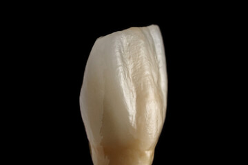 Ceramic tooth crown. Frontal view of a denture. Close-up detailed dental macro shot. The work of a dental technician in a dental laboratory. The concept of orthopedics and implantology.