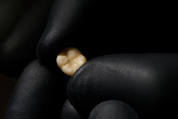Close-up shot of a denture. Ceramic tooth crown in the hands of an orthopedic dentist. Doctor's...