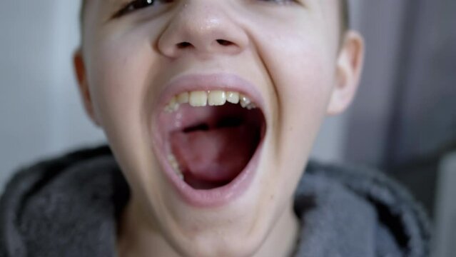 Tired, Sleepy Child Opens his Mouth Wide, Yawns Shows his Teeth, Tongue. Change in facial expression. Emotions. Portrait smiling of teenager opening his mouth. Close-up. Head. Bedtime. Dentistry.