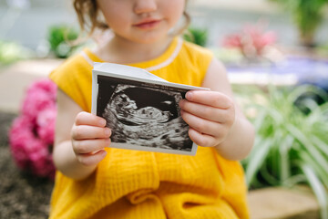 toddler girl holds up ultrasound photo 
