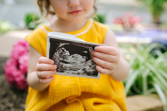 toddler girl holds up ultrasound photo 
