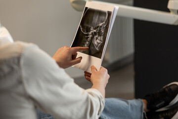 X-ray image in hands of doctor