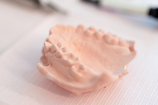Set of dental cast placed on table
