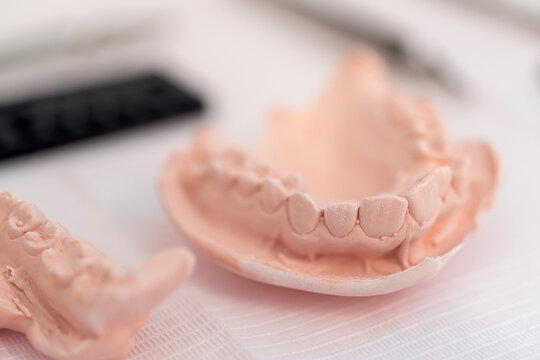 Set of dental casts placed on table
