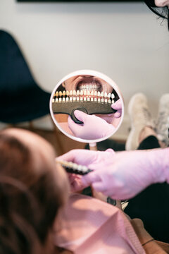 Comparing Teeth To Guide