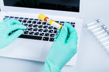 doctor's hands hold blood test tube close up