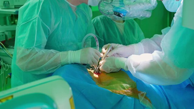 performing a medical operation in the operating room. hands of a surgeon, an assistant and a nurse close-up. the surgeon gives the nurse an instrument