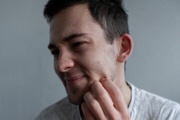 Fototapeta premium Young man struggling with acne on his face caring for his skin pushes acne