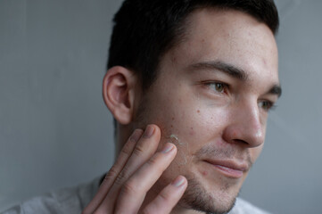 Obraz premium Young man struggling with acne on his face caring for his skin pushes acne applies a moisturizing cream mask of green color on the face 