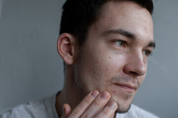 Obraz premium Young man struggling with acne on his face caring for his skin pushes acne applies a moisturizing cream mask of green color on the face 