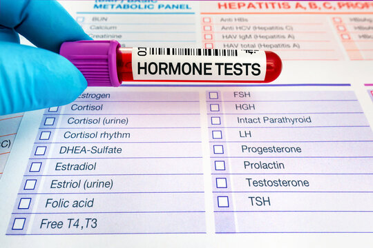 Blood sample for study of levels of hormone tests. doctor holding blood tube for analysis of Hormones in Biochemistry lab